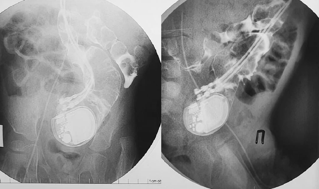 2_21022025.jpg 2_21022025.jpg